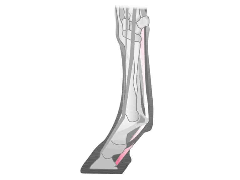deep digital flexor tendon injury in the foot of a horse