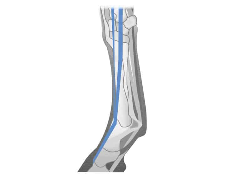 Digital extensor tendon injury in a horse